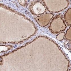 LAP1B Antibody, Novus Biologicals 25 &mu;L; Unlabeled:Antibodies, Polyclonal